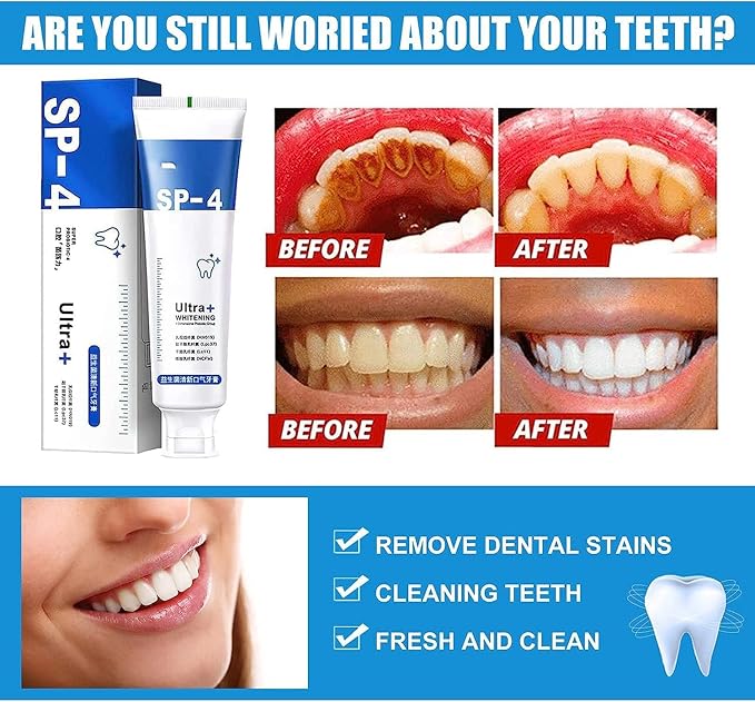 SP-4 Probiotic Whitening Toothpaste (Pack of 2)